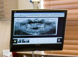 digital x-ray