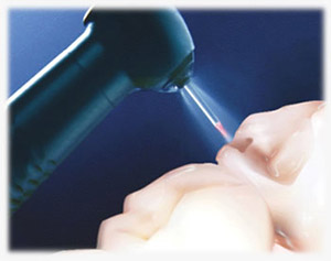 laser dentistry